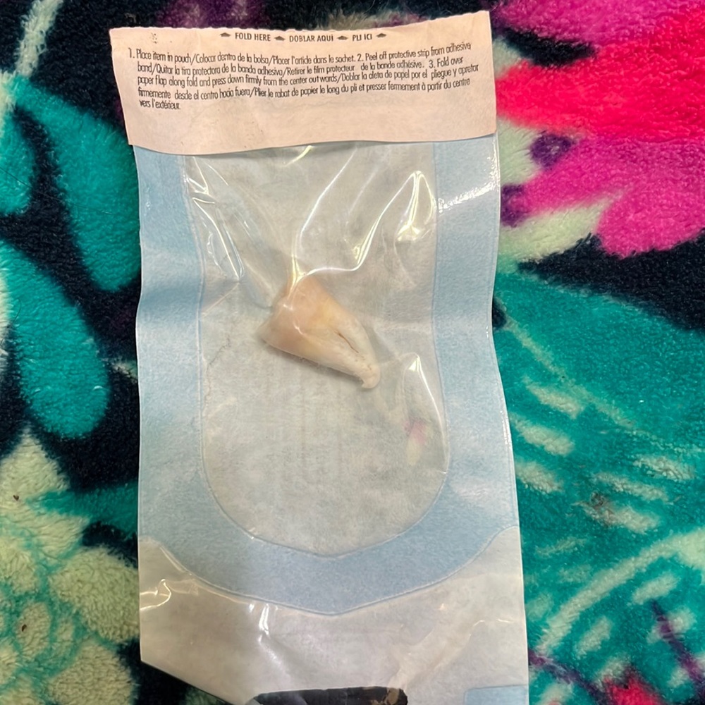 Wisdom tooth